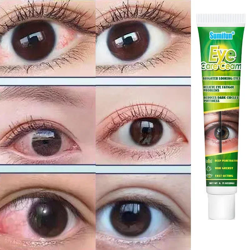 Chinese Herbal Medicine Eye Care Cream Brighter Looking Eyes Relieve Eye Fatigue Problems Reduces Dark Circles And Puffiness