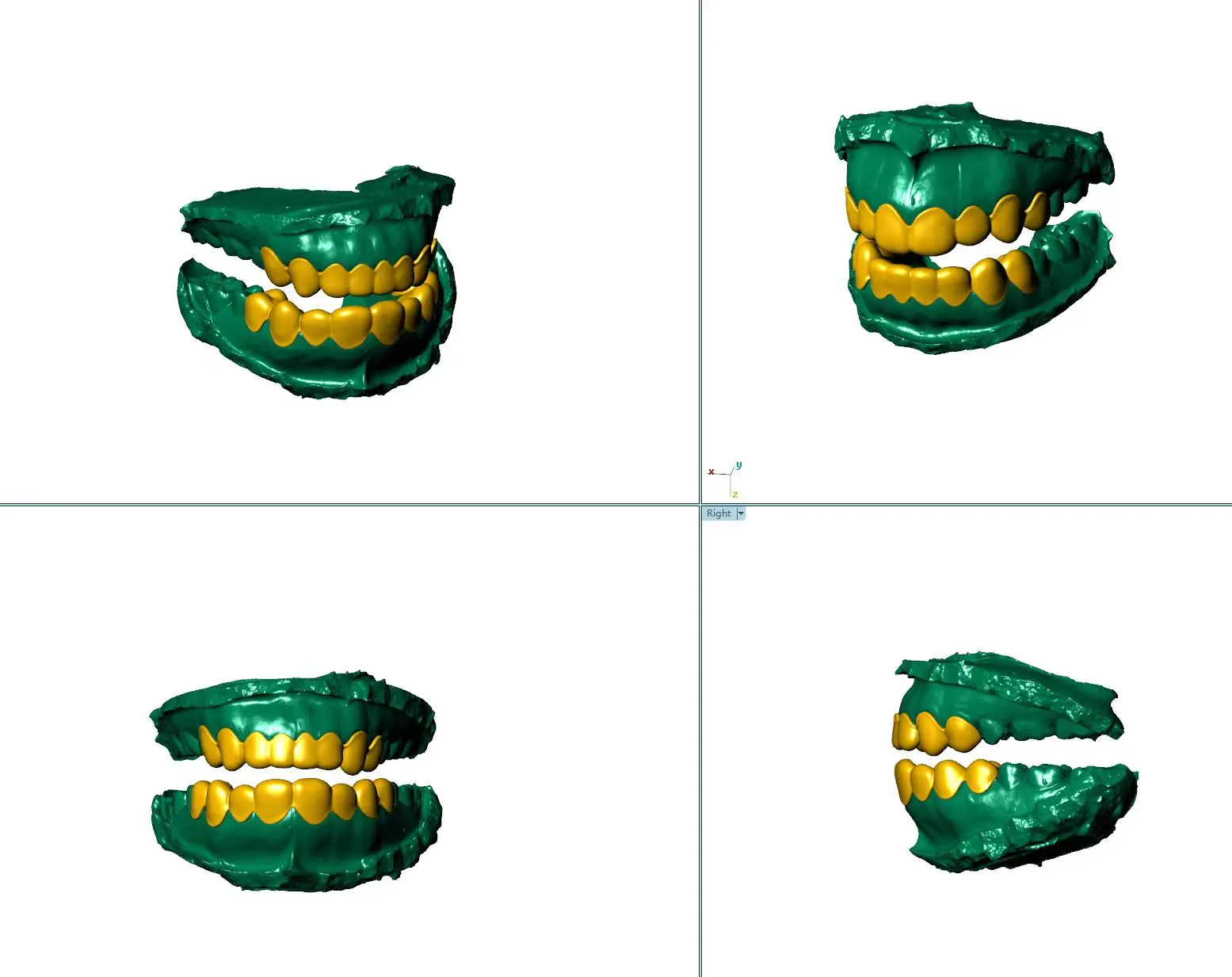 Hip hop Custom Simulation Teeth inlaid VVS Moissanite 8/10 top and 8/10 Bottom 925 Sterling Silver ice Teeth