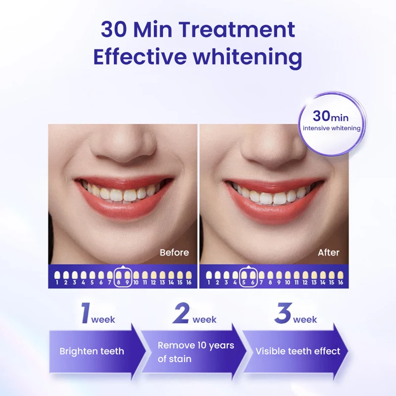 Crest Professional Teeth Whitening Strips Enamel Safe No Pain Sensitivity Teeth Bleaching Strips 14/28 Strips