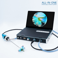 Medical FHD Endoscope Camera System 1080P Endoscopy Camera 60fps For ENT Arthroscopy Veterinary Gynecology Laparoscopy Urology