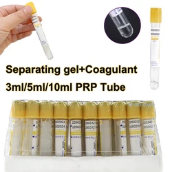 Disposable Vacuum tube 3ml/5ml/10ml test Tube Separation Gel and Clot Activator Yellow cap Test Tube Lab PRP Tube for lab,100Pcs