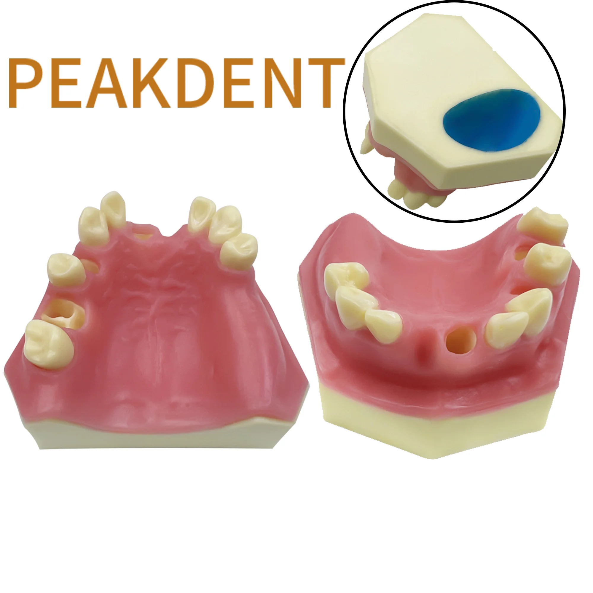 Dental Maxillary Implant Practice Model With Missing Teeth Teaching Model for Dentist Tooth Dentist Demonstration Tool Dentistry