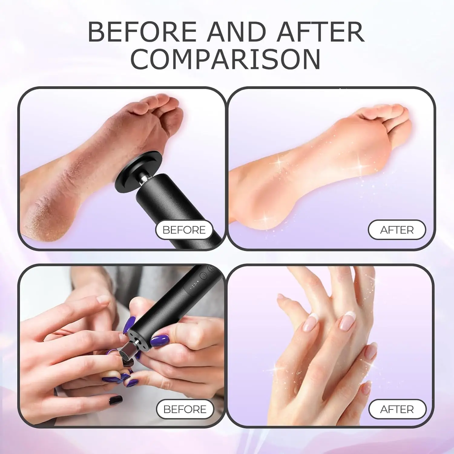 2 في 1 مزيل مسامير القدم الكهربائية القابلة لإعادة الشحن ومزيل الجلد الميت 6 سرعات مجموعة طلاء الأظافر للعناية اليومية