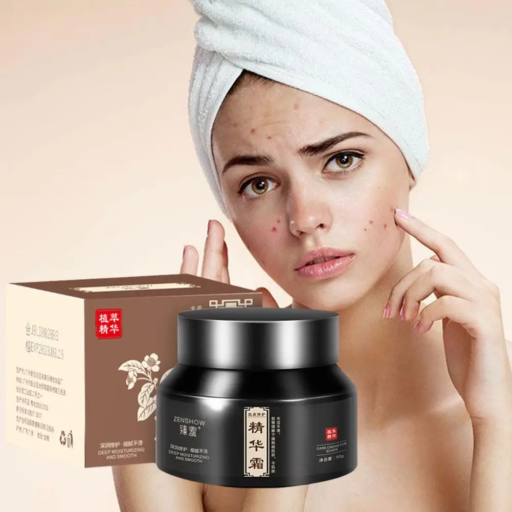 Crema para eliminar pecas, Corrector de manchas oscuras, ilumina la pigmentación, aclara la edad, Melasma, aclara la marca, blanquea el acné, E3S9, 50g