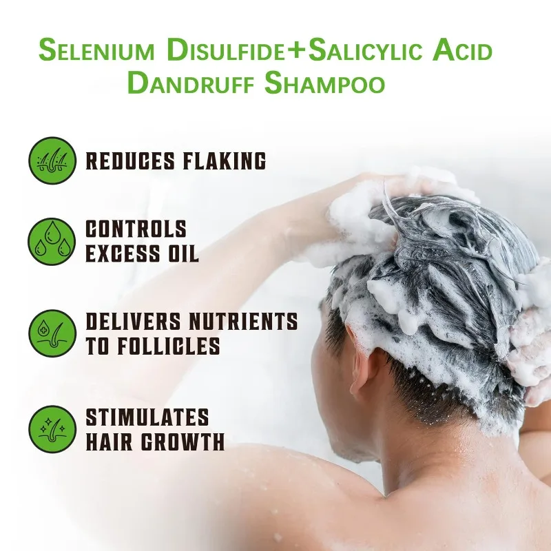 شامبو مضاد للقشرة بحمض الساليسيليك بكبريتيد السيلينيوم 200 مل للعناية بفروة الرأس والتقشير والتحكم في الزيت، نضارة تدوم طويلاً #6