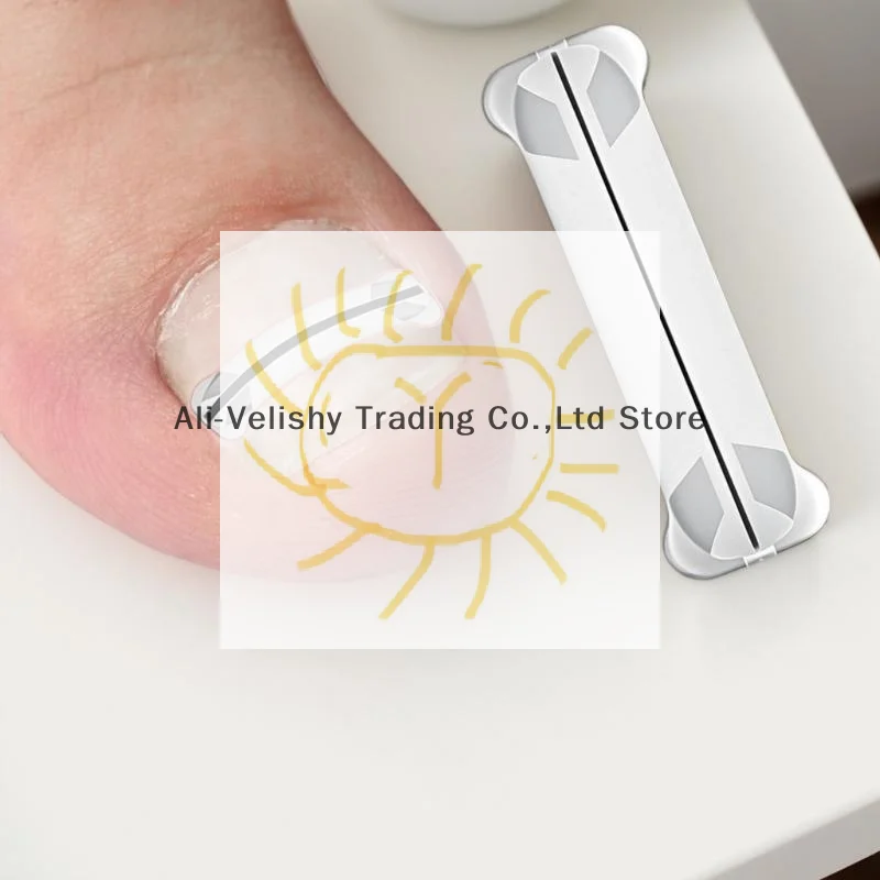 1Pcs 13-20mm Nail Correction Stickers Ingrown Toenail Corrector Patches Paronychia Treatment Recover Corrector Pedicure Tools