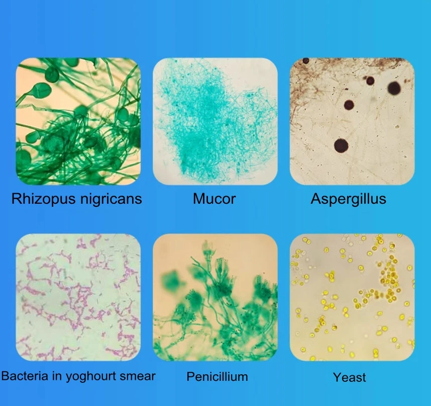 6PC Prepared Mildew Slices Mould Microscopic Slides Fungus Specimen Sample Section Biological Permanent Mycete Slicing for Lab