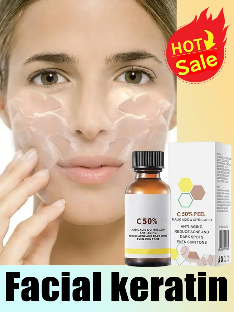 Acid Peeling Serum Chemical Exfoliant Peel for remove Face Dark Skin Spots Whiten Lighten Melanin Peeling Solution Skin Peel