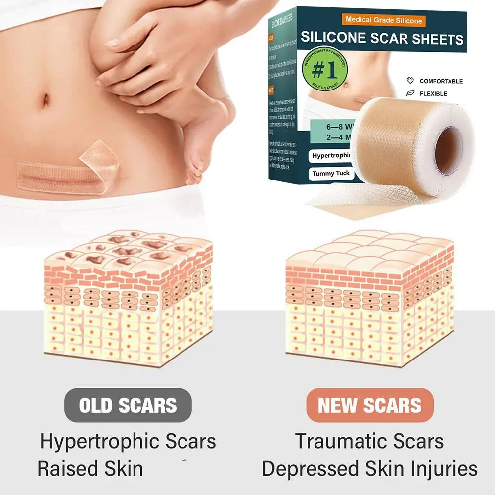 1 Rolka Naklejek Kryjących w Kolorze Skóry, Kryjący Tatuaże, Niewidoczna Taśma na Blizny, Naklejka na Poparzenia, Wodoodporny Plaster na Tatuaże, Plamki Narodzinowe I4L4