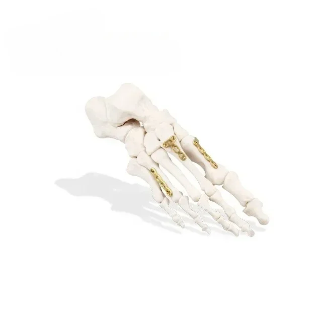 Hand and Foot Instrument Set Names of Orthopedic Metacarpal & Phalangeal Instruments