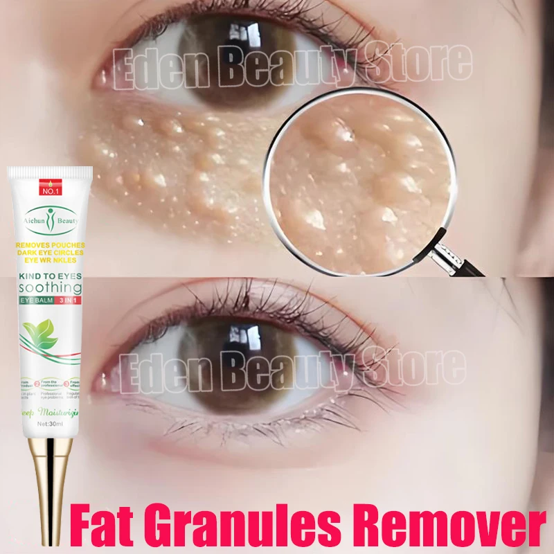 

Fat Granules Remover Eye Cream Remove Dark Circle Anti-Puffiness Firming Cream Antiaging Fade Fine Line Repair Skin Barrier Care