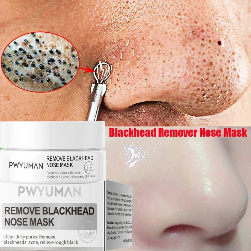 White Blackhead Remover Nose Mask Pore Shrinkage Treat Pimple Deep Cleansing Repair Products Oil Control Korean Skin Care