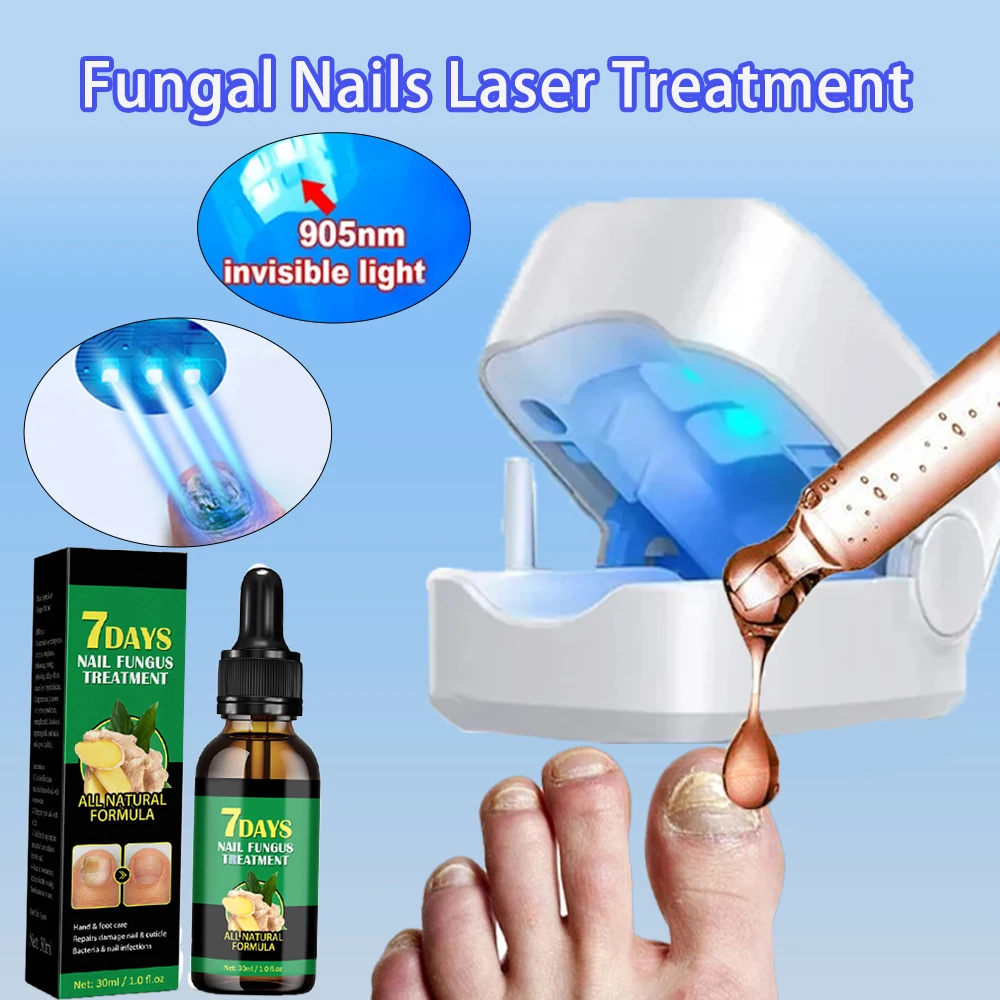 Fungal Nails Laser Treatment Device Nail Fungus Essence Repair Toenail Fingernail Fungus Treat Onychomycosis Removes Nail Fungus