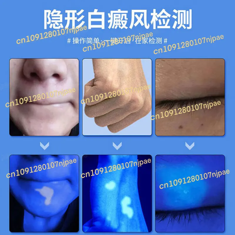 흰 반점, 이끼, 피부 곰팡이를 확인하기 위한 LED 목재 램프 백반증 감지기, 고양이용 의료용 돋보기