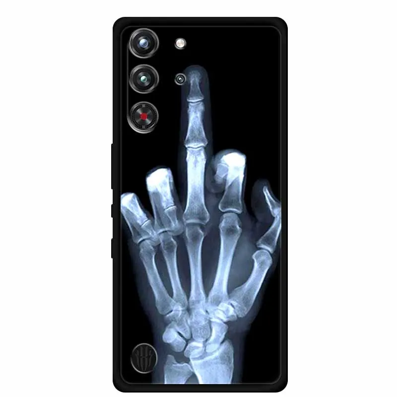 For ZTE nubia Red Magic 10 Pro Case Magic10 Pro Coque Silicone Soft Back Cover Case For ZTE Nubia REDMAGIC 10 Pro Phone Case Bag view 2