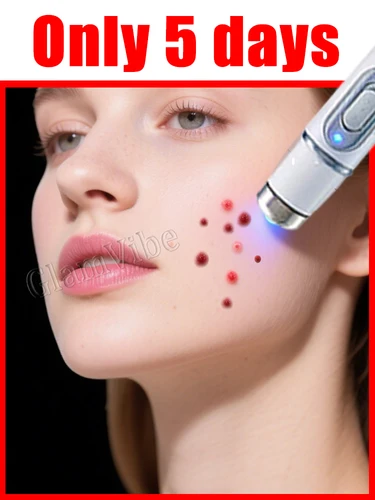 Imagen 1 del producto Proporcionar experiencia cómoda, herramientas de cuidado con puntero láser.