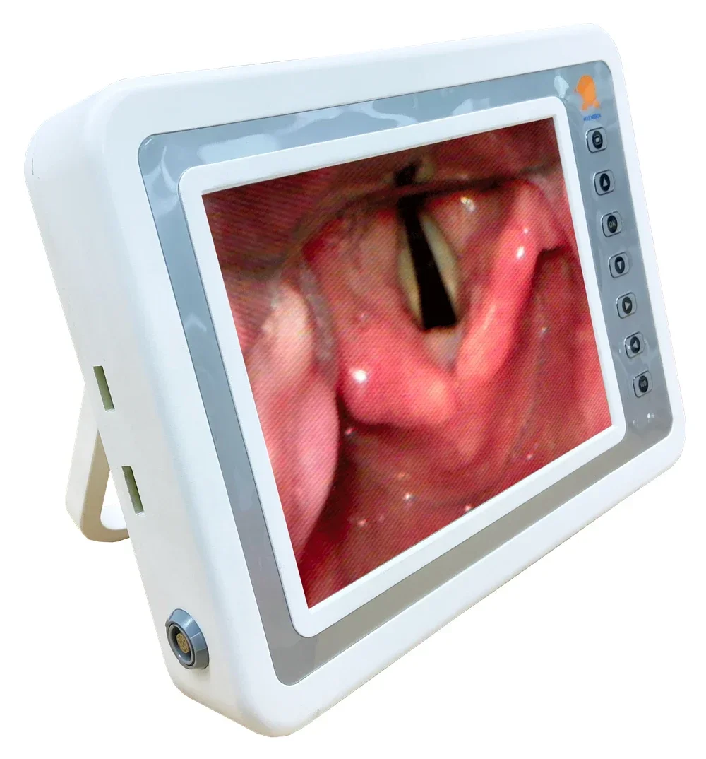 

High-End Quality 8 Inch Medical Hd Endoscope Screening Monitoring Display