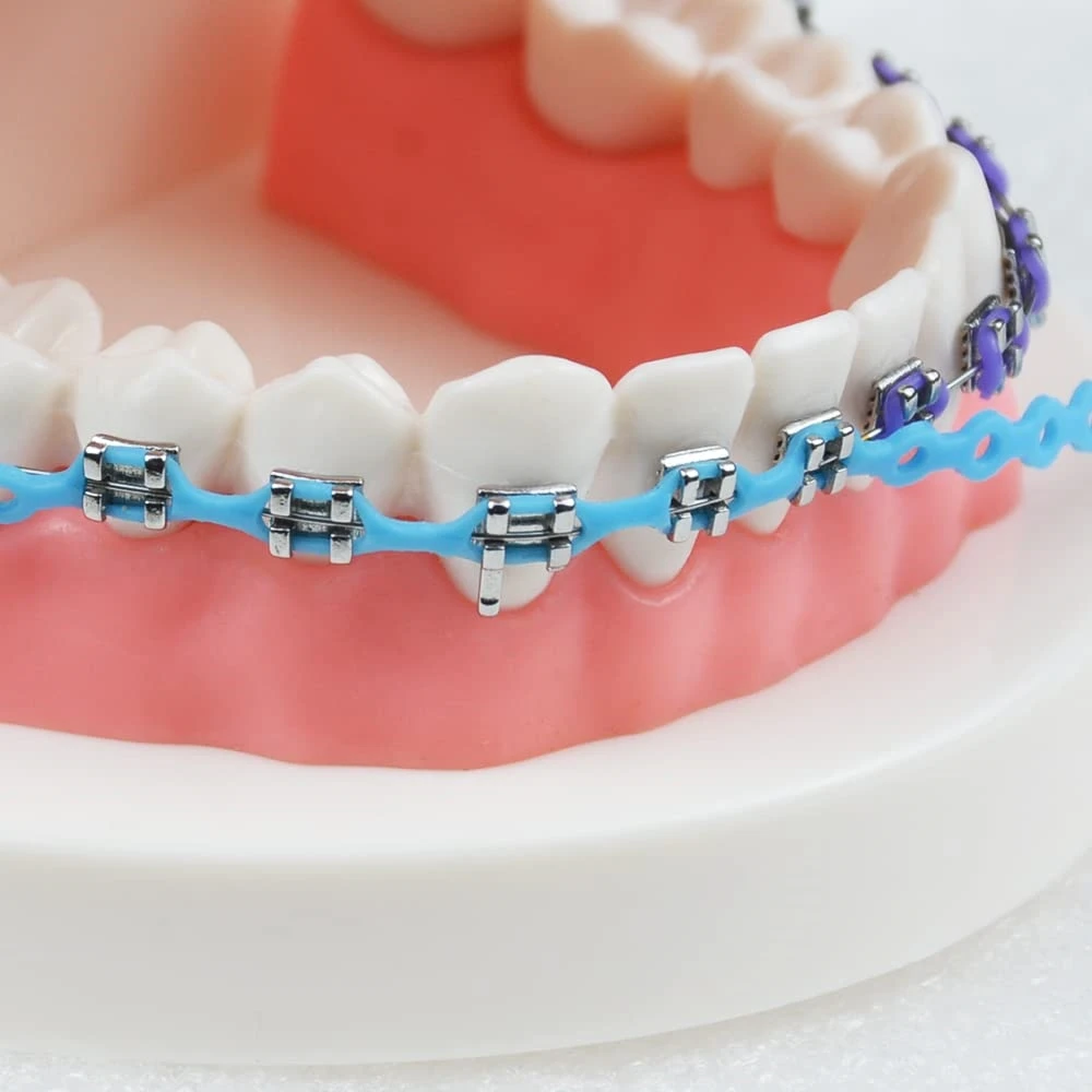 Zahnärztliche kieferorthopädische elastische Power Chain Ultra Powerchains Gummibänder lang/kurz/kontinuierlich 15 Fuß 4,5 m Zahnarzt-Ortho-Materialien – Detail 10