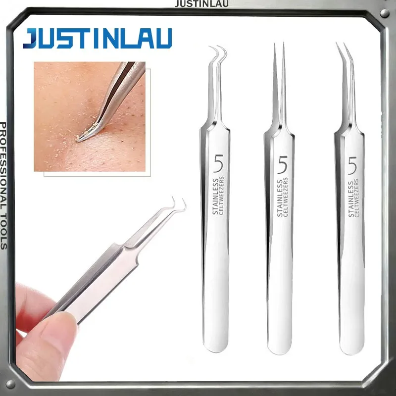 Alemán Ultrafino No. Pinzas de 5 puntas para espinillas y puntos negros, herramienta especial para salón de belleza para extracción y eliminación de acné