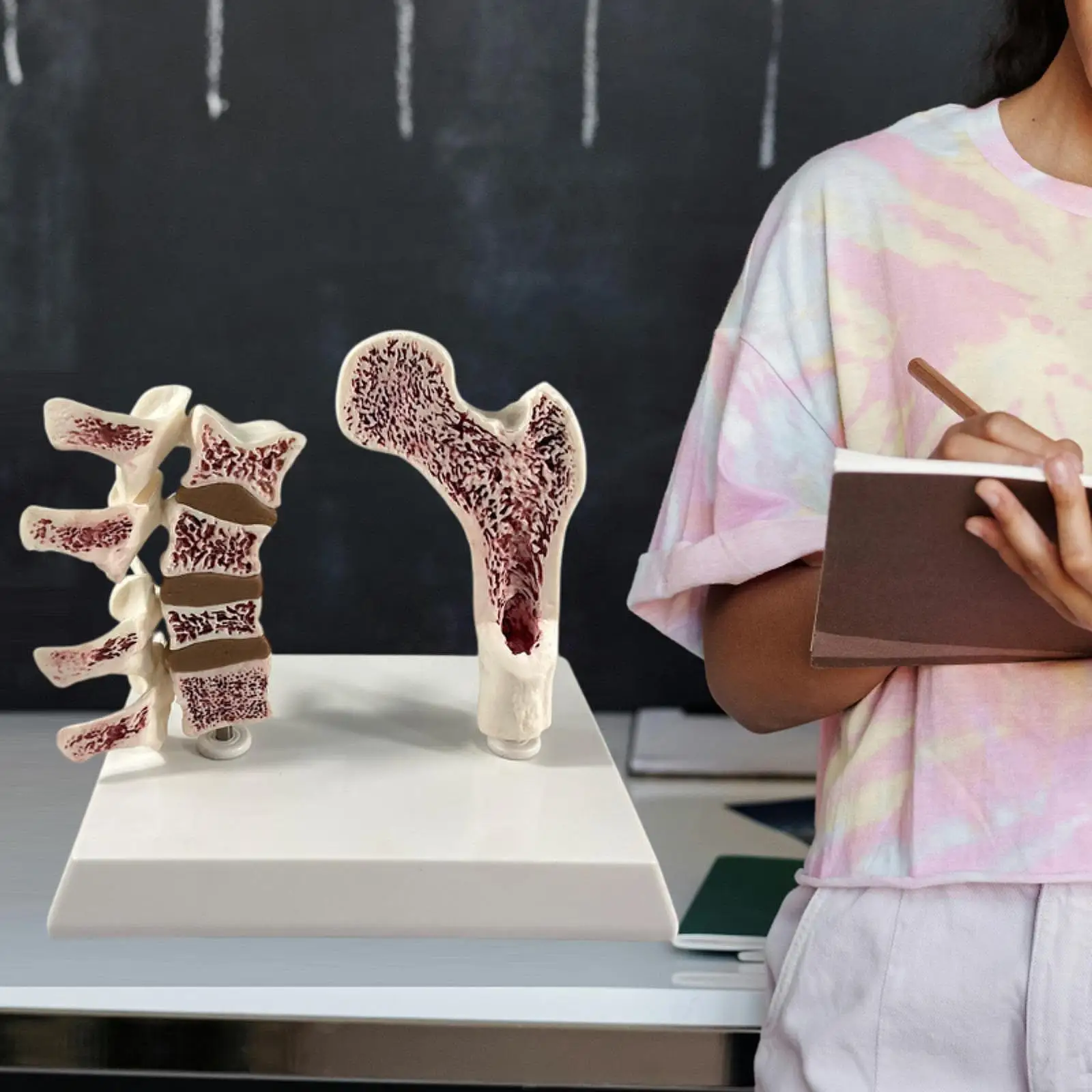 Анатомическая модель остеопорозу человекаской кости, обучающий реквизит для учебных сеансов