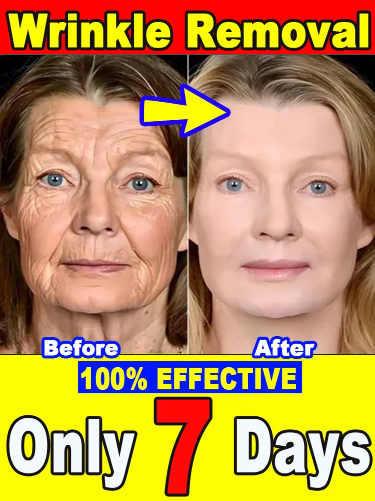 أصغر سنًا بنسبة 100%، تختفي التجاعيد