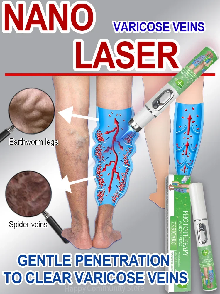 Vendita calda vena Laser