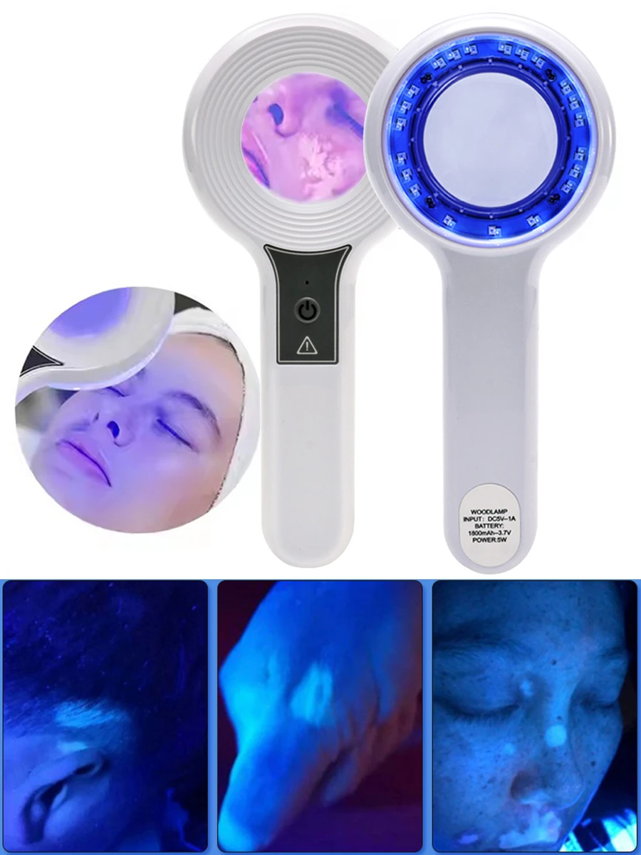 Nouveau bois lampe analyseur de peau Portable Salon du visage analyseur de beauté lampe UV bois dermatologie pour analyser l'examen de test