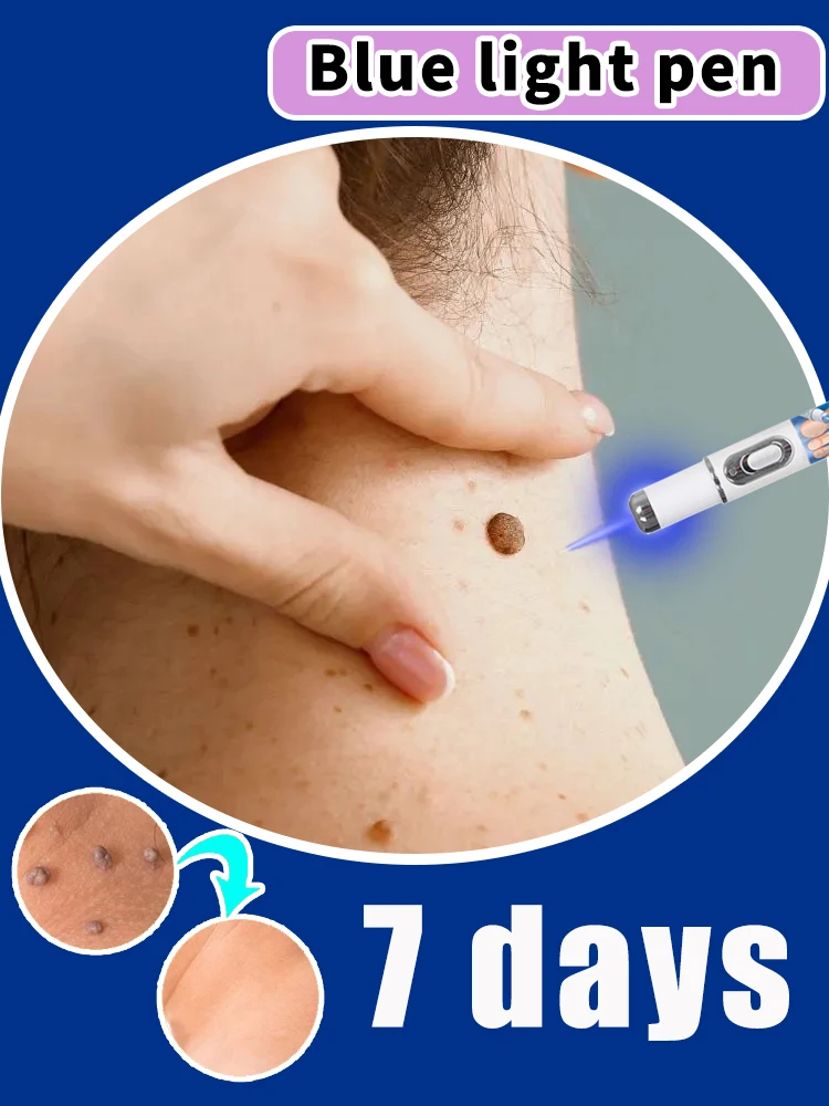 

Pʀᴏғᴇssɪᴏɴᴀʟ sᴏʟᴜᴛɪᴏɴ ᴛᴏ sᴋɪɴ ᴘʀᴏʙʟᴇᴍs