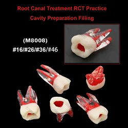 Dental Teeth Model Endo Root Canal Teeth Teaching RCT Practice Model Kilgore Nissin Type For Cavity Preparation Filling