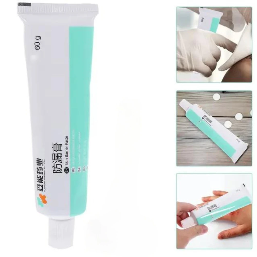 Venta al por mayor, polvo para el cuidado de la piel, accesorios para estoma, herramienta de crema para después de la cirugía, pasta de barrera a prueba de fugas para bolsa de ostomía, ungüento anti