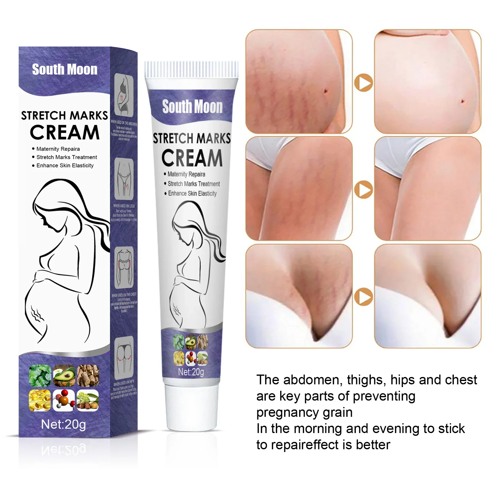 20G South Moon Stretch Marks Cream Postpartum Pregnancy Lines Mulmy Cream Fade Growth Lines Obesity Stretch Marks Repair Skin