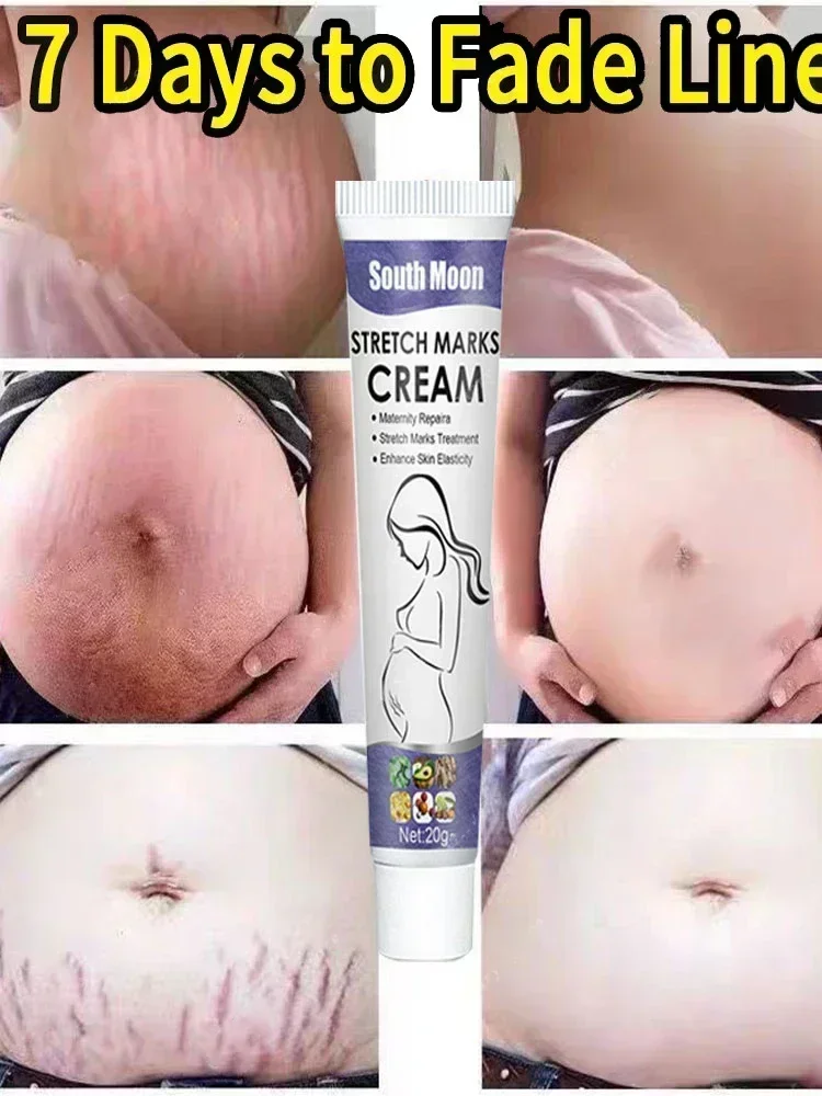 Spray para estrías de 7 días para el embarazo, elimina la obesidad posparto, cicatriz de mujer sin efecto lateral, realce de glúteos, crema corporal para la piel