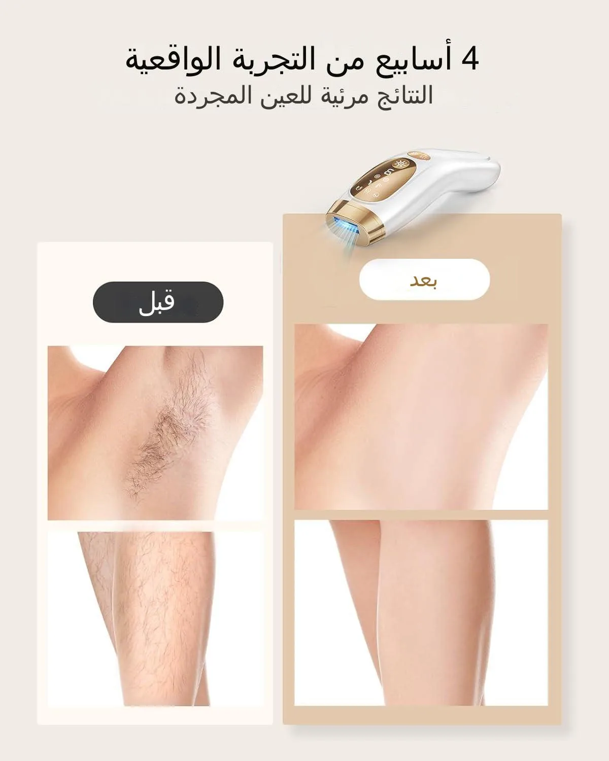 جهاز إزالة الشعر بالليزر IPL ومضات غير محدودة تبريد الجليد غير مؤلم علاج الجسم بالكامل آمن إزالة الشعر المنزلي السريع