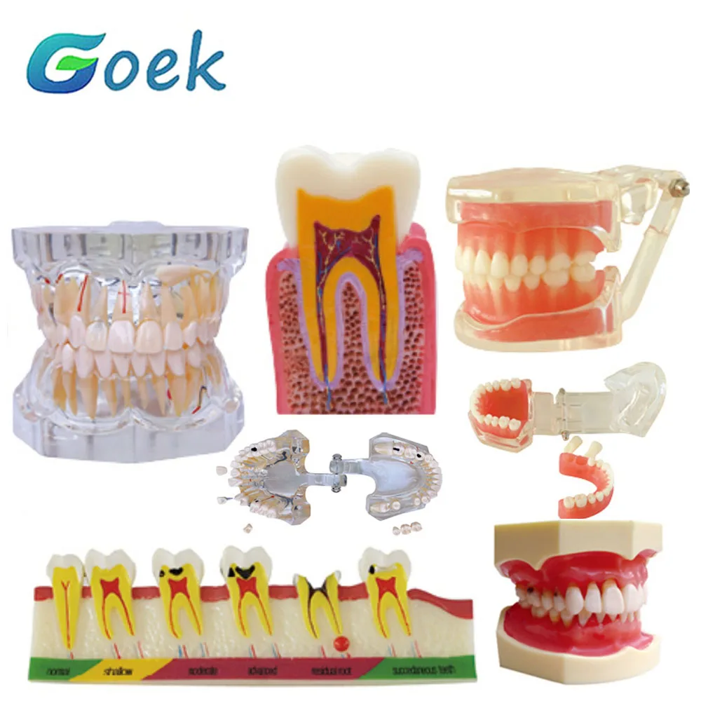 

Dental Teaching Model Adult Pathological Detachable Periodontal Disease Dental Caries Model Dentistry Orthodontics Teeth Model