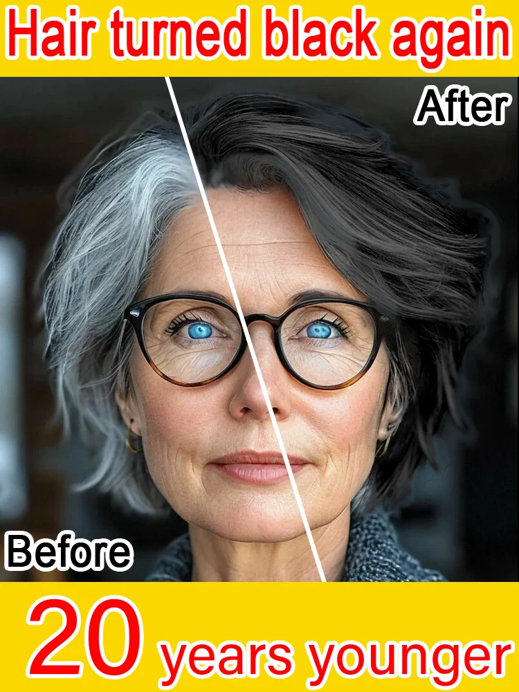 Turn white hair into black hair, naturally black hair, make you 20 years younger again, without side effects