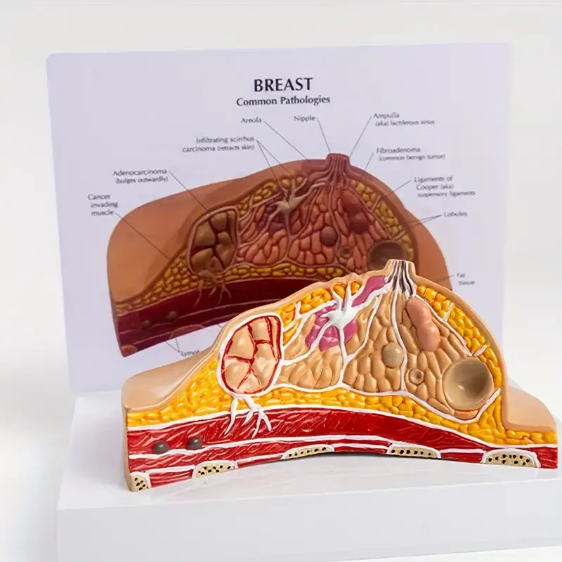 Sztuczny ludzki patologiczny Model kobiecej piersi-choroby medyczne i modele anatomiczne raka