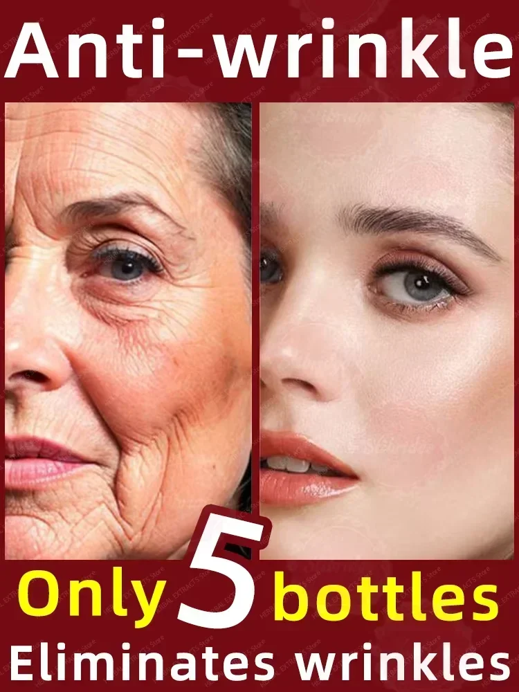 Solve all facial wrinkle problems