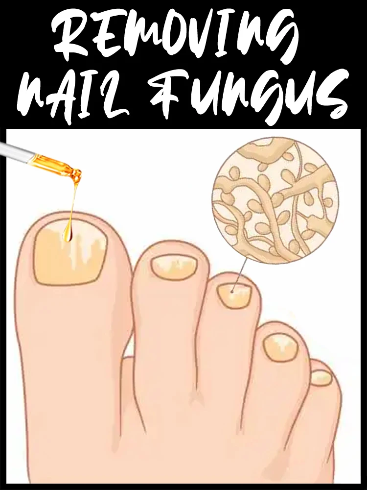 

Generation-2, Technology changes life and Rejuvenator - Fungus Prevention Technology - Adjustable Control & Safety Sensor