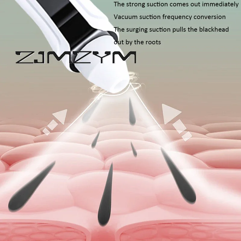 Usb recarregável visual removedor de cravo poros faciais cabeça preta limpador sucção cravo instrumento
