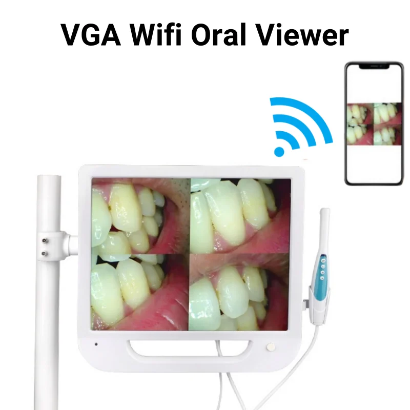 JUMTOP Dental HD intra-orale camera WIFI CMOS LED intra-orale onderzoekskamera met 17-inch monitorscherm