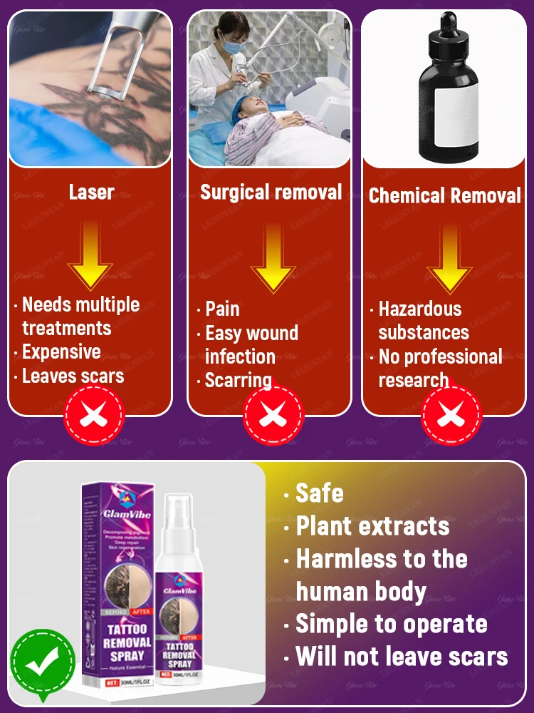 Tattoo-Auflösespray, Pflanzenextrakte, schnelle und effektive Tiefenreinigung, kein Laser erforderlich