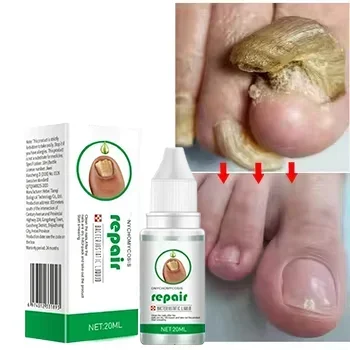 Fungal Nail Treatment Essence Oil Nail Fungus Repair Toenail Fingernail Treatment Onychomycosis with Mushrooms