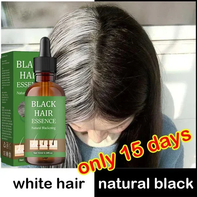 

Natural and Healthy White To Black hair No hair color,no allergies Anti-grey quickly turns white hair into black repairs NEW