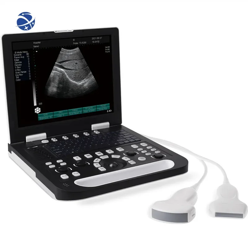 Sonoscape Portable Laptop 2D black and white Doppler Ultrasound Scanner Machine for Veterinary and Human