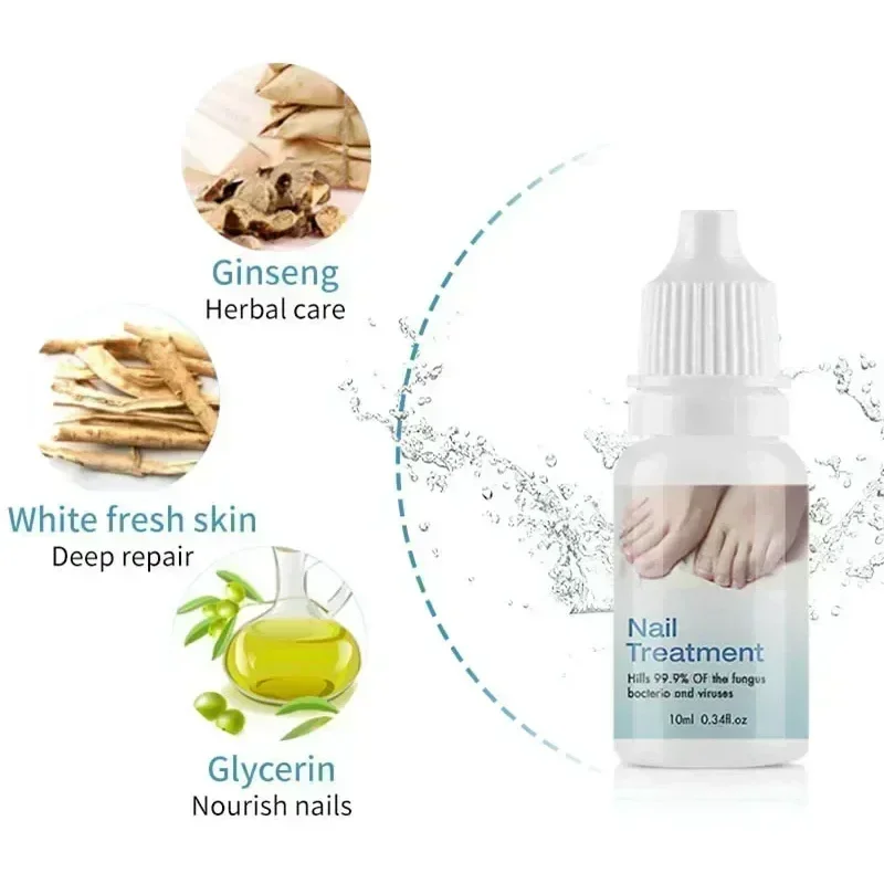 Anti Infection Paronychia Onychomycosis Nail Fungus Treatment Serum Toe Fungal Repair Products Hand Foot Care Removal Gel