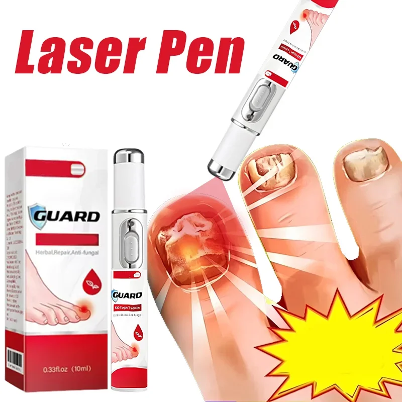 손발톱 진균증 치료용 LED 레이저 기기, 손발톱 진균증 청소용 905nm 적외선 470nm 청색광 손발톱 관리