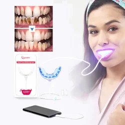 Blanchiment des dents à lumière LED, lampe portable, chargement USB, lumière bleue, blanchiment des dents pour la maison