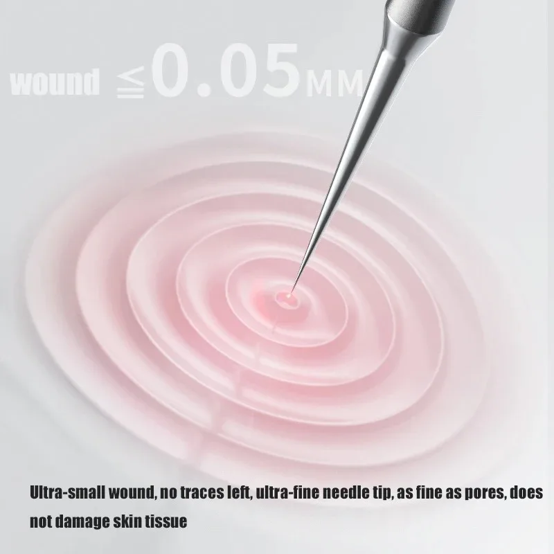 Nowy 1 szt. Niemiecki Ultra-cienki Klips do Usuwania Pryszczy, Wągrów i Zaskórników, Specjalny do Salonów Kosmetycznych, Narzędzie do Usuwania Tłuszczowych Zawartości i Przebarwień