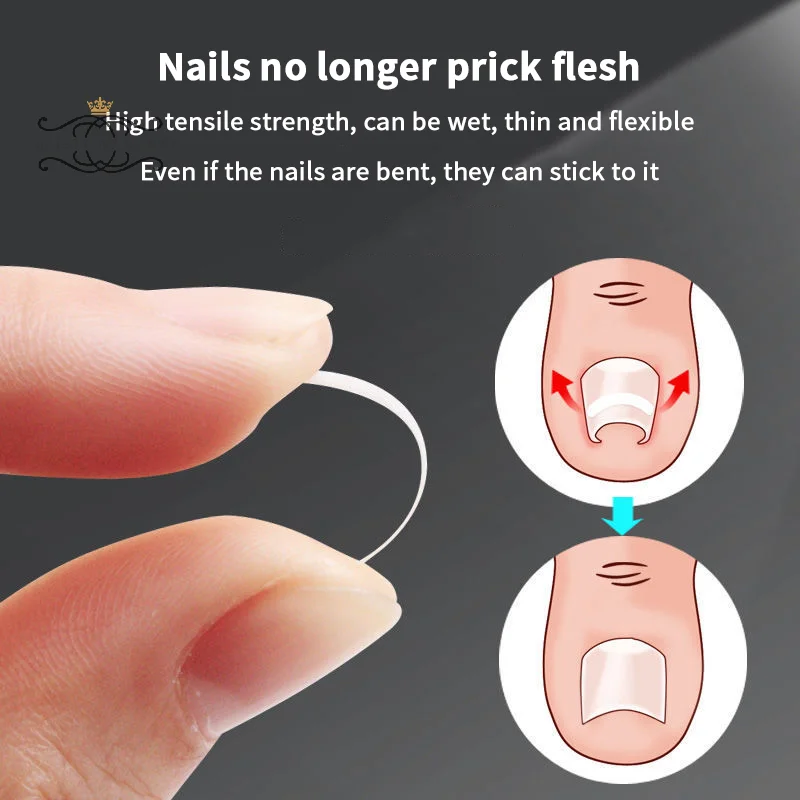 10PCS Strumenti per pedicure Trattamento delle unghie dei piedi incarnite Strumento di correzione dell'unghia del piede incarnita Adesivo patch elastico Raddrizzamento Clip Brace