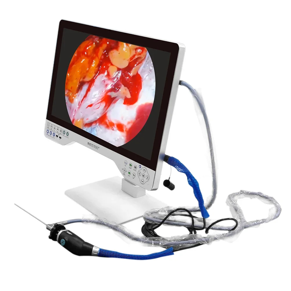 4K Monitor Medical Endoscopy Camera built in Light source USB Record 4 in 1 ent endoscopy